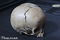 VBS_3142 - Cranio infantile - Mostra Body Worlds